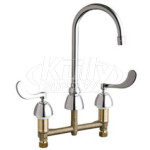 Chicago 201-AGN2AE3-317AB Concealed Hot and Cold Water Sink Faucet